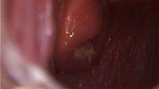 Avy Open Pussy with Speculum - porn video