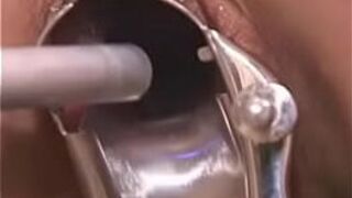 electric bondage treatment - porn video